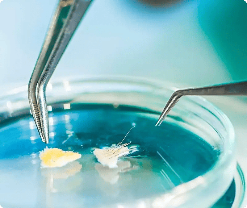 pierre-fabre-sag-helt